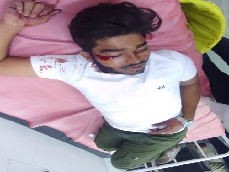 गंभीर रूप से घायल छात्र को इलाज के लिए अस्पताल में भर्ती कराया गया है।