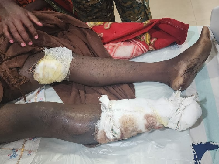 युवक के पैर के चिथड़े उड़ गए। - Dainik Bhaskar