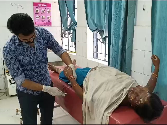 झुलसी महिला का चल रहा इलाज।
