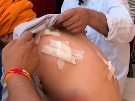 इलाज के लिए अस्पताल में भर्ती घायल आप नेता आशु वर्मा - Dainik Bhaskar