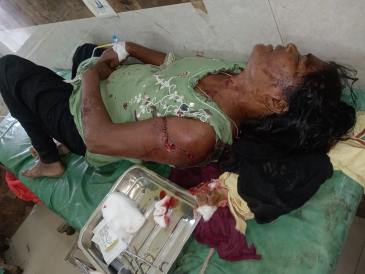 महिला पर भी भालू ने हमला कर किया घायल