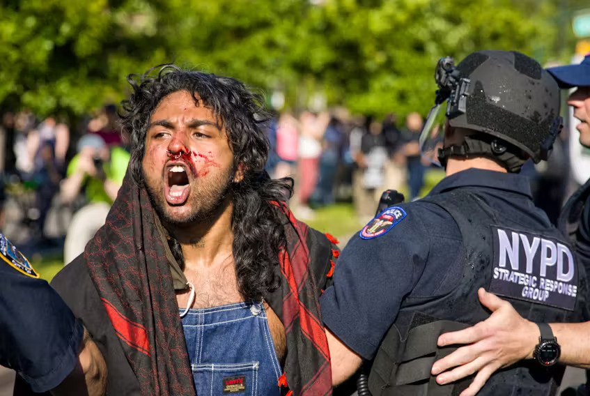 इस दौरान कई लोगों को गंभीर चोट आ गई, जिससे प्रदर्शनकारी भड़क गए।