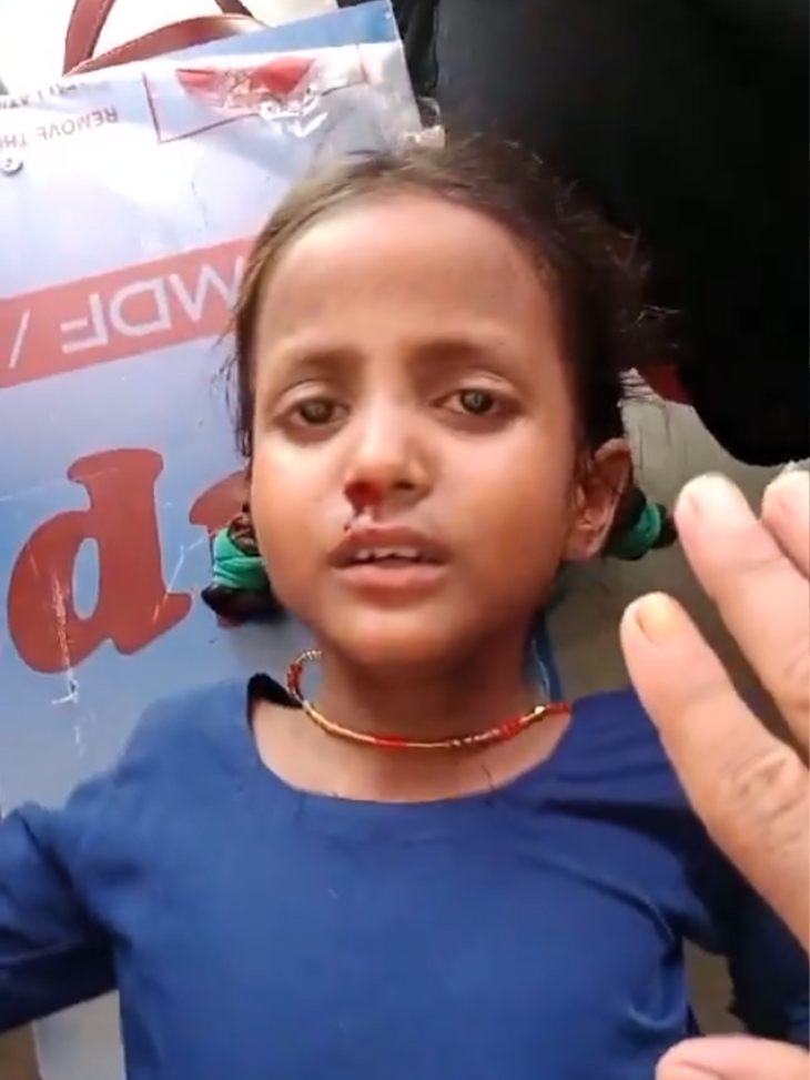 पटना के बिहटा में छात्रा के नाक से खून निकलने लगा।