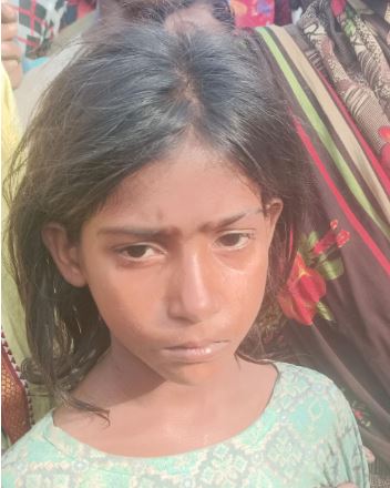 यह घायल बच्ची बिट्‌टू की फोटो है।