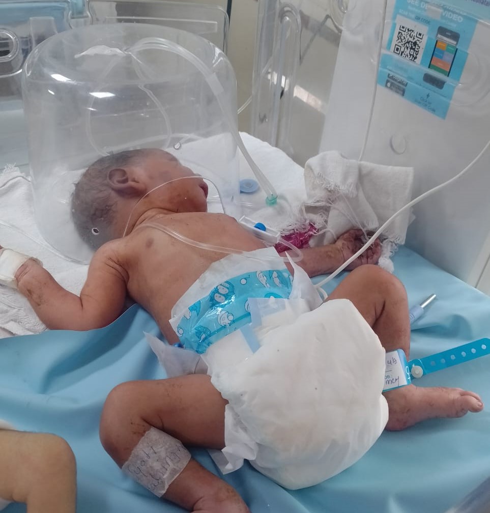 बच्चा पूरी तरह स्वस्थ है लेकिन एहतियात के लिए उसे स्पेशल केयर यूनिट में रखा गया है।