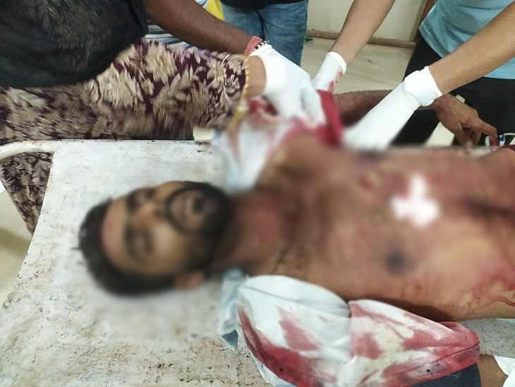 चाकुओं से युवक पर किए कई बार वार।