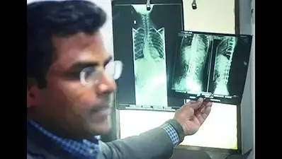 एक्स-रे में महिला की रीढ़ में छूटी सुई देखी जा सकती है।