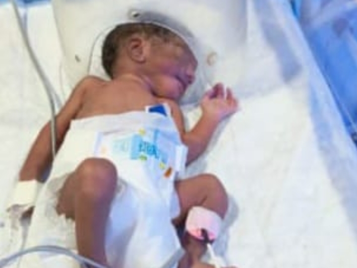 Prayagraj Three children born Without operation mother child all ...