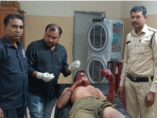 घायल ग्रामीण का इलाज जारी।