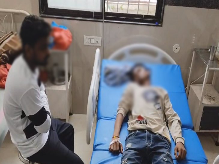 घायल नाबालिग को दुर्ग के एक अस्पताल में भर्ती कराया गया है। - Dainik Bhaskar