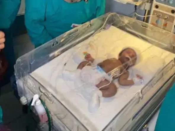 बच्ची को 48 घंटों के लिए ऑक्सीजन पर रखा गया है।