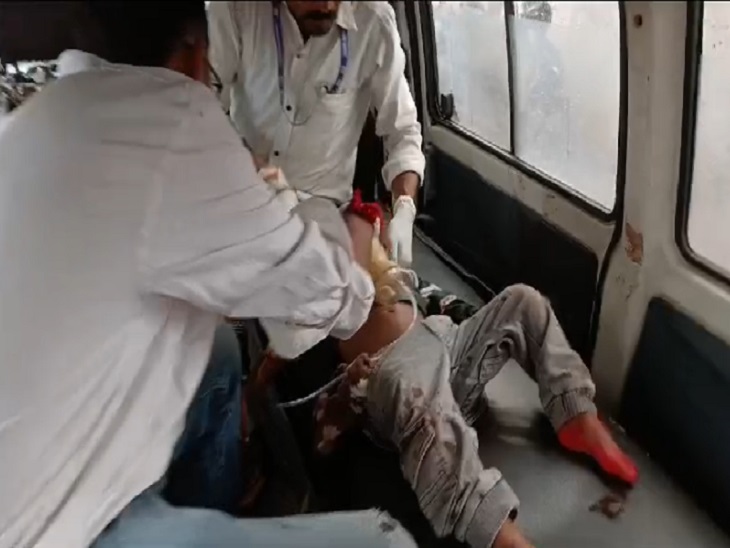 घायल हालत में बच्चे को रेफर किया गया था जिला अस्प्ताल दुर्ग
