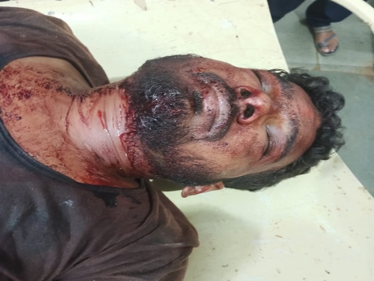 आरोपी गुलशन गोस्वामी ने भी त्रिशूल से अपनी गर्दन पर वार कर खुदकुशी का प्रयास किया है।