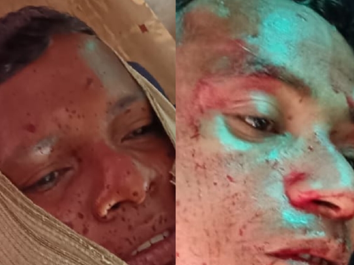 दोनों घायल जवानों को एयरलिफ्ट कर रायपुर लाया गया है। - Dainik Bhaskar