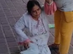 बंदर के हमले में घायल हुई महिला पर्यटक।