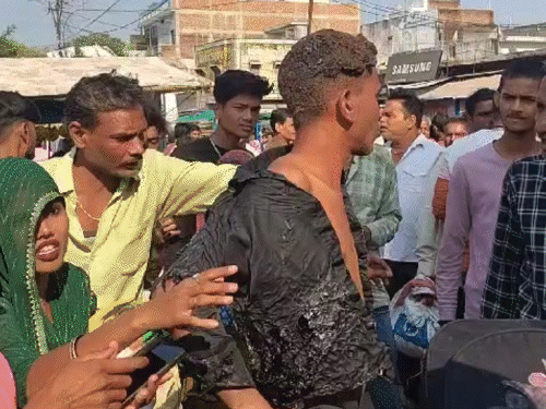 हादसे में एक युवक की शर्ट बुरी तरह जल गई। शर्ट उसे शरीर पर चिपक गई।