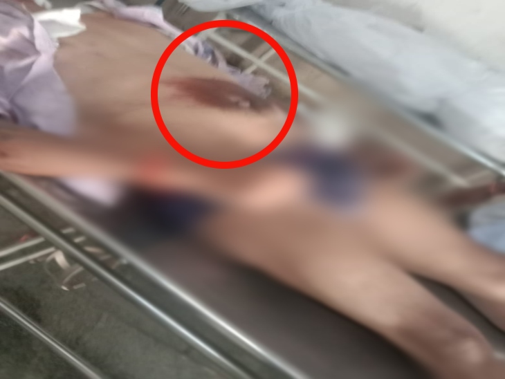 हादसा इतना भयानक था कि युवक के पेट में कार के टायरों के निशान बन गए है। - Dainik Bhaskar