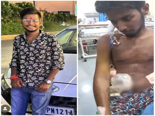 पीड़ित यश शर्मा की घटना के पहले और बाद की तस्वीर।