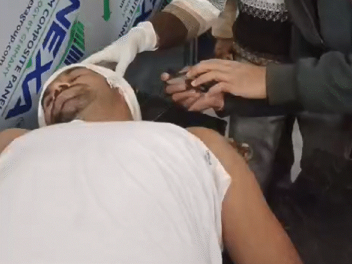 दूसरे युवक के भी कंधे से छू कर गोली निकल गई।