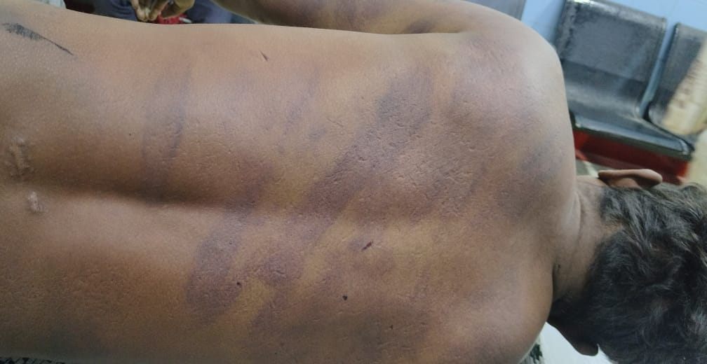 धमतरी में धान चोरी के संदेह में ग्रामीणों ने युवक को पीट-पीटकर मार डाला।