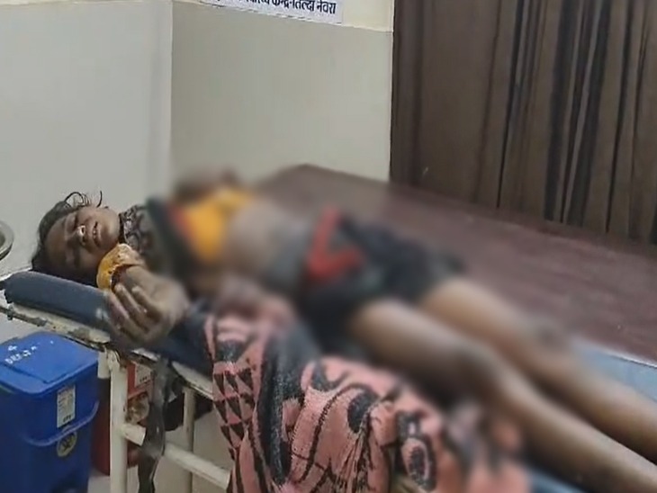 महिला का पेट का बुरी तरह जल गया। पति-पत्नी के बीच विवाद के बाद महिला ने ऐसा कदम उठाया है।