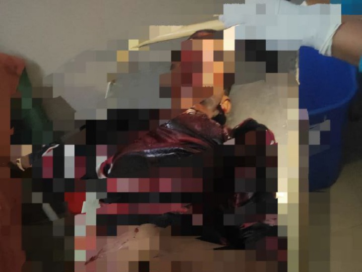 मृतक उमेश यादव का शव - Dainik Bhaskar