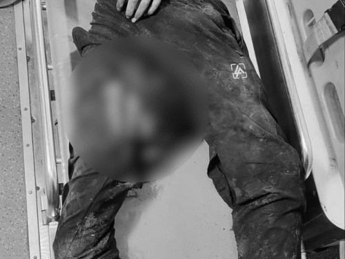 हादसे में करीब 11 लोग घायल हो गए। इनमें से तीन की हालत गंभीर बनी हुई है।