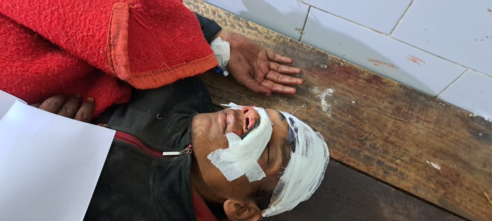 डीएमसीएच में भर्ती ट्रेन से गिरकर जख्मी हुआ अज्ञात युवक।