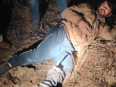 एनकाउंटर में घायल बदमाश। - Dainik Bhaskar