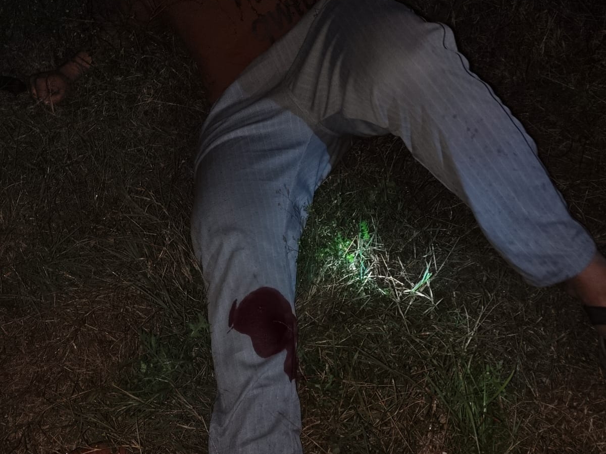 घायल बदमाश।