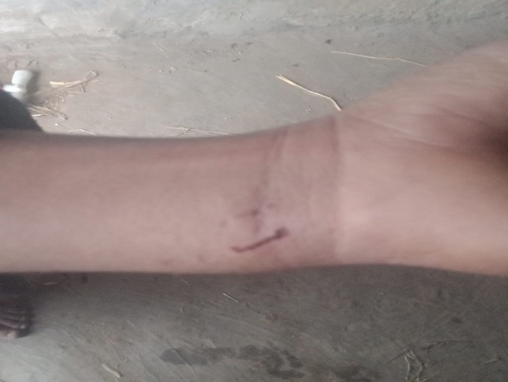 ਮ੍ਰਿਤ ਰਹਿਮਾਦਿਨ ਦੀ ਛੋਟੀ ਧੀ ਦੇ ਪਾਸੇ ਇਕ ਹਥਿਆਰ.