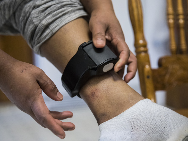 Such ankle monitors are placed in the feet of illegal immigrants, with the help of which they are monitored. - Dainik Bhaskar