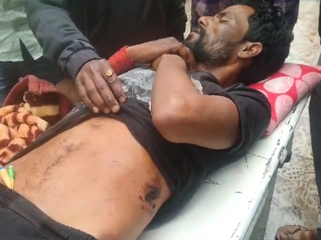 अस्पताल के बाहर गोली लगने से घायल युवक कालू वाल्मिक - Dainik Bhaskar