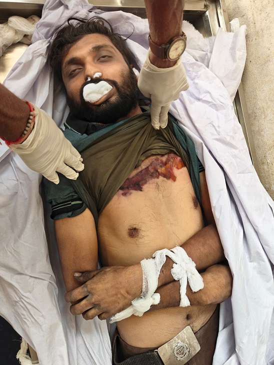 सीने में गहरी चोट लगने से हुई मौत