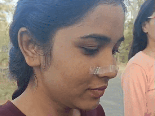 उदयपुर के रेजीडेंसी स्कूल सेंटर पर आज एंट्री के दौरान 2 छात्राओं की नोज पिन (लौंग) नहीं खुली। इसके बाद सेंटर्स के स्टाफ ने उनकी नाक पर टेप चिपकाई