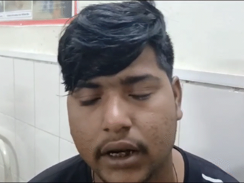 रवींद्र ने कहा- मुझे लगता है कि ड्राइवर को झपकी आ गई होगी।