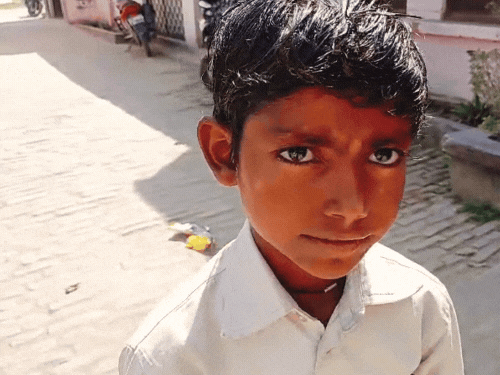 घराबाहेर पडल्यावर लचके तोडतात कुत्रे: यूपीतील बहराइच जिल्ह्यात शांतता, मुलांनी सोडली शाळा; काठ्या घेऊन घराबाहेर पडतात लोक जखमी अजय म्हणाला- ४ ते ५ कुत्र्यांनी माझ्यावर हल्ला केला.