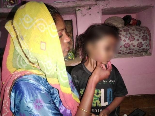 रावतभाटा में मां के साथ जा रहे एक 4 साल के बच्चे को आवारा कुत्ते ने काट लिया।