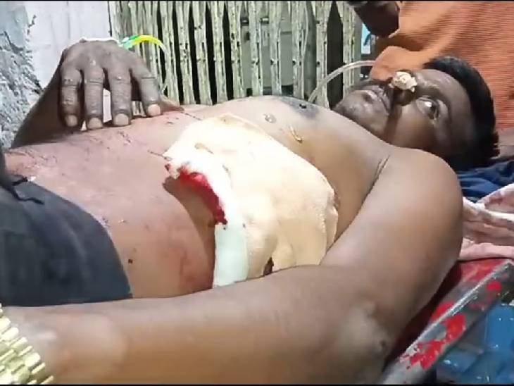 गंभीर रूप से घायल हालत में दोनों को इलाज के लिए मेडिकल कॉलेज में भर्ती किया गया।