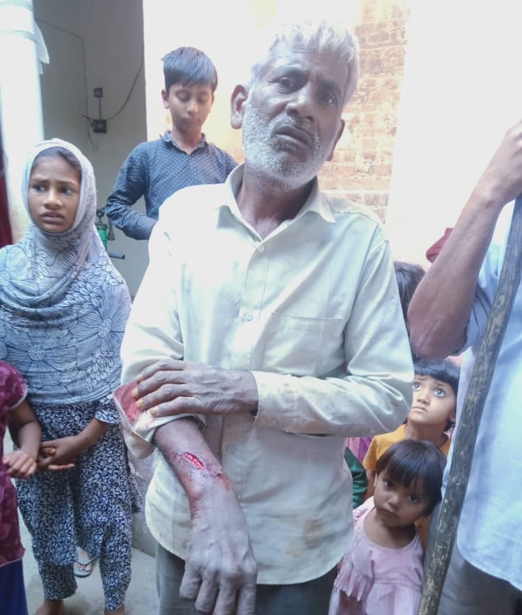 तेंदुए के हमले में घायल किसान।