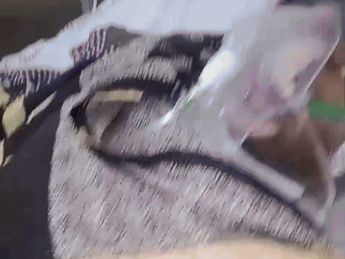 ਇਲਾਜ ਲਈ woman ਰਤ ਨੂੰ ਰੋਹਤਕ ਪੀਜੀਆਈ ਵਿੱਚ ਦਾਖਲ ਕਰਵਾਇਆ ਗਿਆ ਸੀ. 16 ਮਾਰਚ ਨੂੰ ਇਲਾਜ ਦੌਰਾਨ ਉਸ ਦੀ ਮੌਤ ਹੋ ਗਈ.