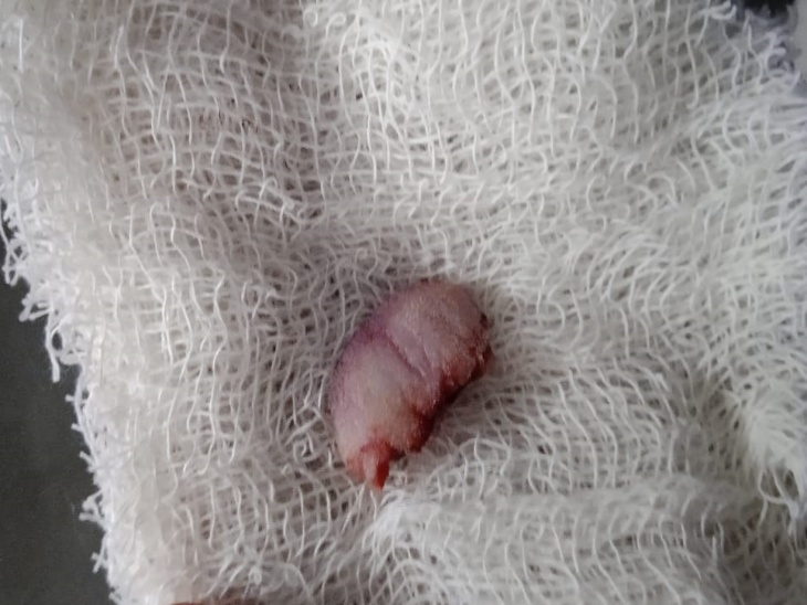 Rajasthan Marital Dispute; Wife Cuts Husband Tongue | Jhalawar News