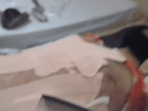 ਜ਼ਖਮੀ ਨੌਜਵਾਨ ਨਿਜੀ ਹਸਪਤਾਲ ਵਿੱਚ ਇਲਾਜ ਅਧੀਨ.