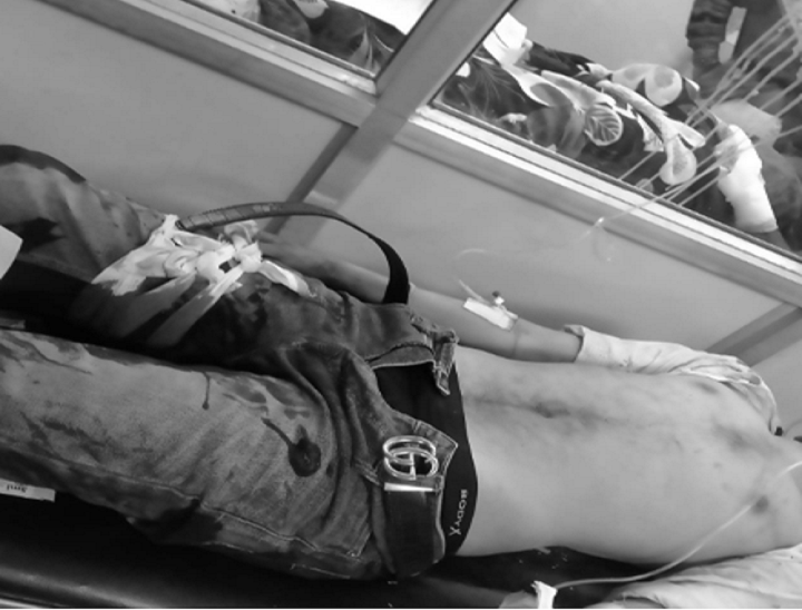 अस्पताल में दाखिल घायल स्टूडेंट।