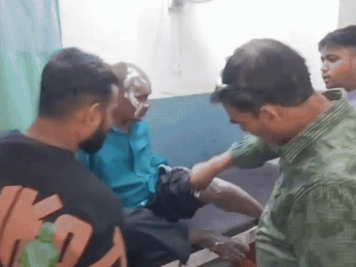 सिविल अस्पताल में आग में झुलसे व्यक्ति का इलाज करता अस्पताल का कर्मचारी