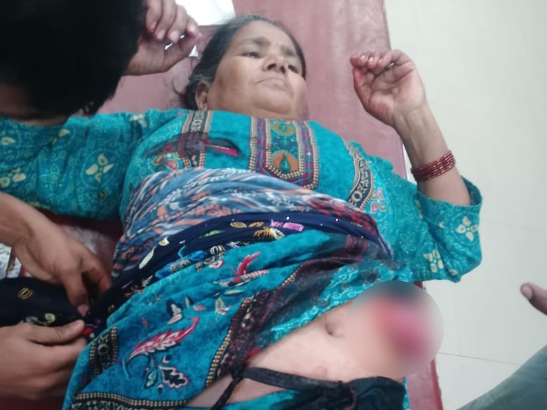 अस्पताल में भर्ती घायल महिला