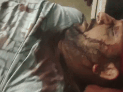 हमले के बाद हाॅस्पिटल में एडमिट कराने के दौरान - Dainik Bhaskar