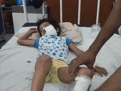 लहूलुहान हालत में बच्ची को जिला अस्पताल ले जाया गया, जहां उसकी गाल की लटकी हुई खाल को सिला गया।