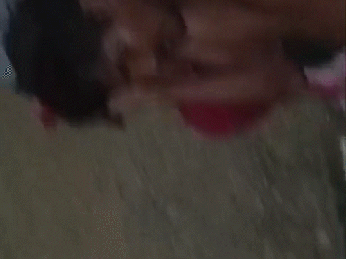 सूरजपुर में घायल सड़क किनारे पड़े हैं। सड़क पर खून ही खून बिखरा पड़ा है।