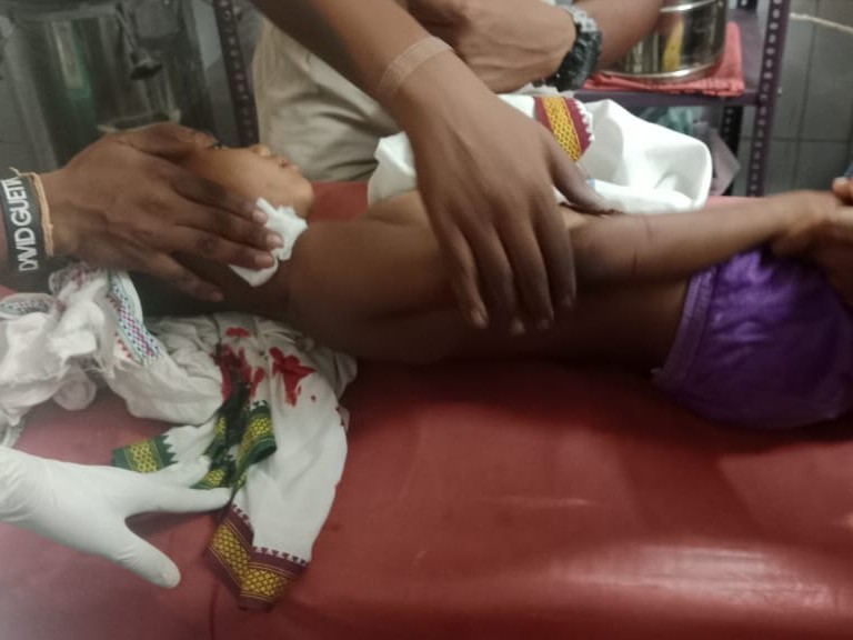बच्चे के गले से खून निकल रहा था।